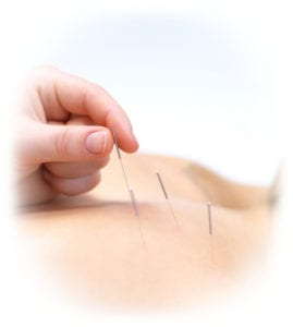 Acupuncture2